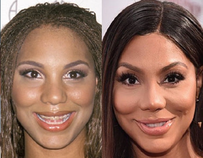 The alleged before and after pictures of Tamar's lips surgery.