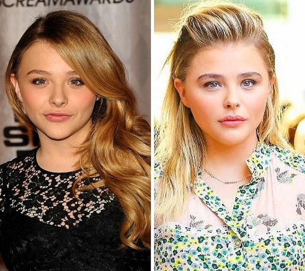 Chloë Grace Moretz Almost Got Plastic Surgery At 16 Thanks To