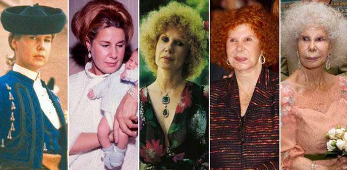 Late Duchess of Alba Cayetana Fitz-James Stuart Plastic Surgery and Disaste...