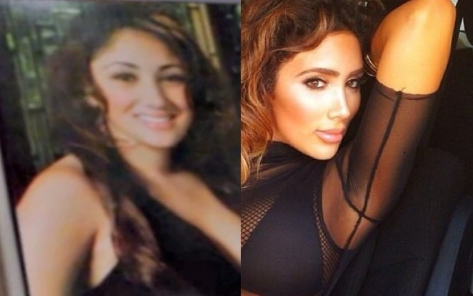 Nikki Baby before (left) and after (right) plastic surgery. 