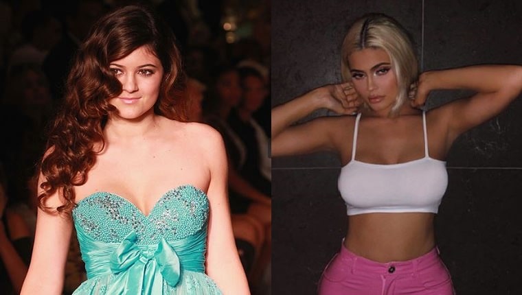 Kylie Jenner Before and After Breast Surgery
