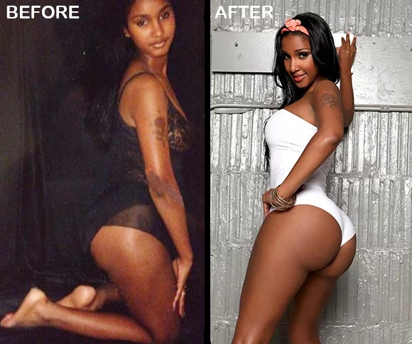 Bernice Burgos before and after picture.