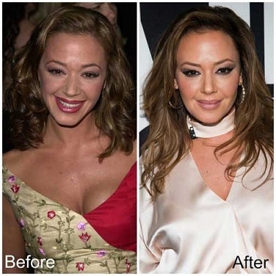 A picture of Leah Remini before (left) and after (right). 