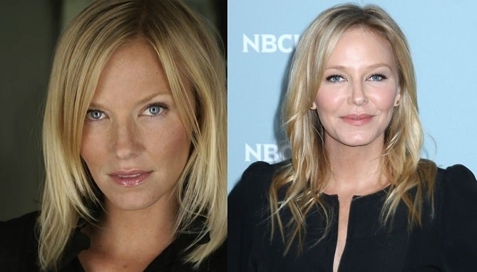 Kelli Giddish’s Plastic Surgery and Implants – Before and After ...