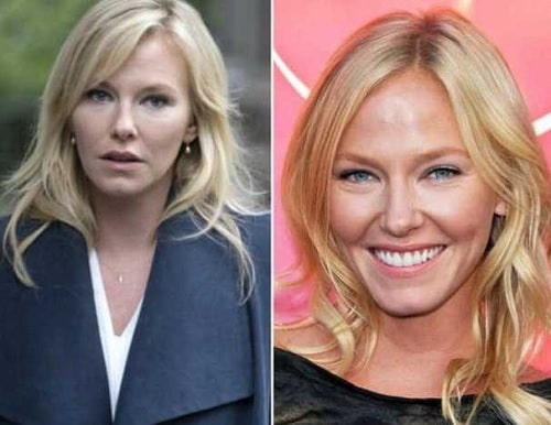 Kelli Giddish’s Plastic Surgery and Implants – Before and After ...