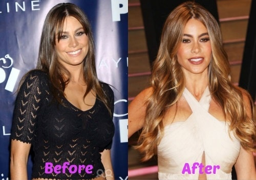 Sofia Vergara Before & After.