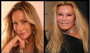 Did Jocelyn Wildenstein Regret Her Plastic Surgery The Answer May Shock You - 88lekgm