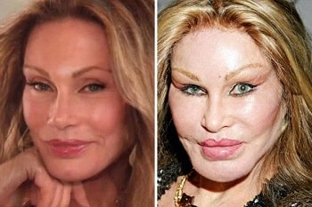 Jocelyn Wildenstein Plastic Surgery Failure Gives Odd Looks – Before ...