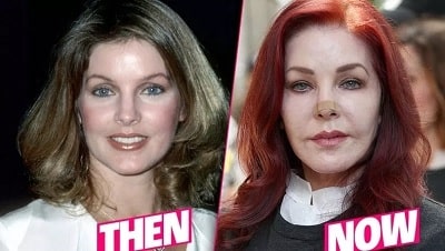 Priscilla Presley Plastic Surgery and Disaster | Compare Before and ...