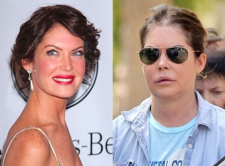 Lara Flynn Boyle Plastic Surgery - Never Admitted But Pictures Suggests ...