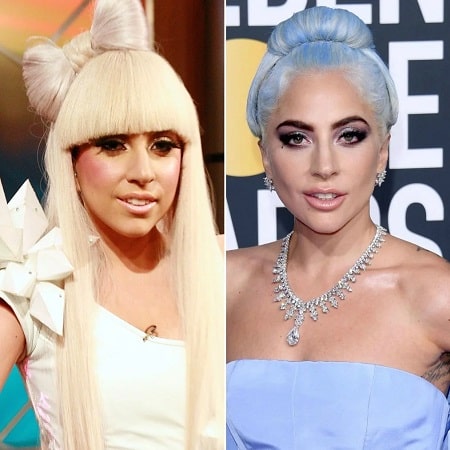 Lady Gaga’s Nose Job and Other Plastic Surgeries – Before and After ...