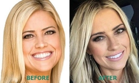 Christina el Moussa's Plastic Surgery – Before and After Pictures ...